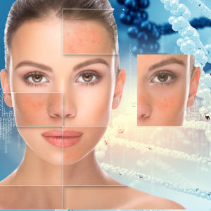 A groundbreaking study engineered skin bacteria to treat acne, using the a bacterium that produces NGAL. NGAL is a protein that is involved in the mechanism of action of the powerful acne drug isotretinoin, also known as 13-cis-retinoic acid and sold under the brand name Accutane among others