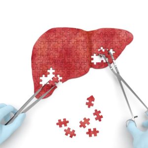 Verve And Vertex Agree To Co-develop In Vivo Gene Editing Program For Liver Disease