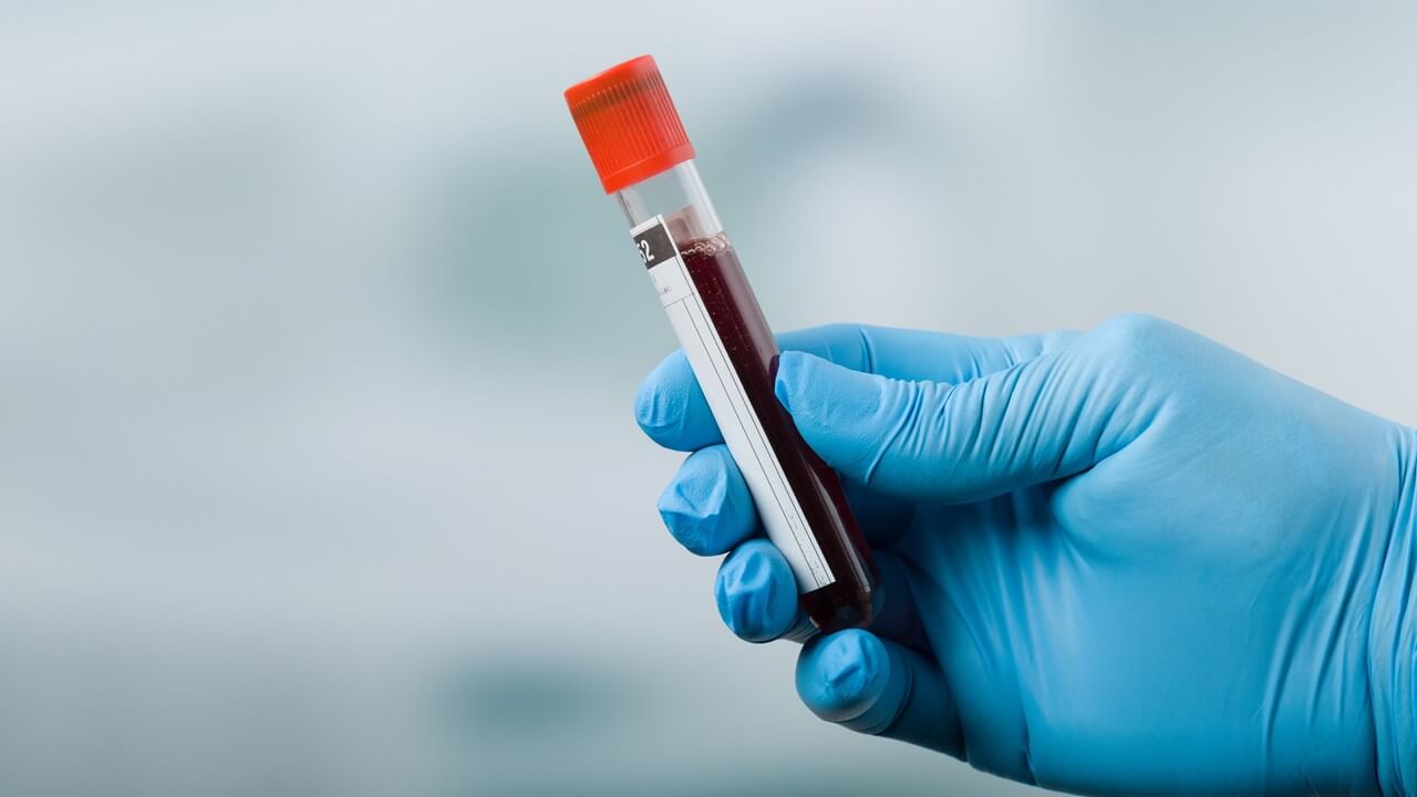 NHS To Trial GRAIL’s Blood Test That Can Accurately Detect Over 50 Cancers at Early Stages