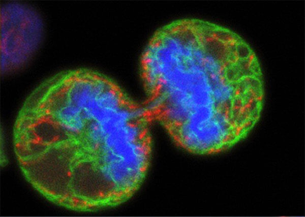 T-VEC, an oncolytic virus, works by infecting and killing tumor cells, like these dividing melanoma cells, and stimulating an immune response against cancer cells throughout the body. Credit: National Cancer Institute at NIH; Wellcome Images