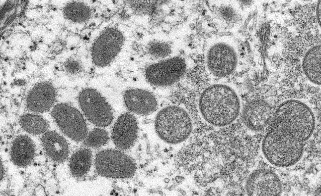 Monkeypox Virus Sample (US CDC 2022)